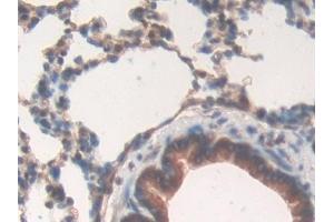 anti-Ribonuclease/angiogenin Inhibitor 1 (RNH1) (AA 108-358) antibody