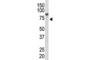 Western Blotting (WB) image for anti-Protein Inhibitor of Activated STAT, 2 (PIAS2) antibody (ABIN2996779) (PIAS2 anticorps)