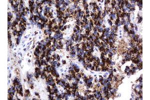 Image no. 3 for anti-Galactosidase, beta 1 (GLB1) antibody (ABIN1498467)