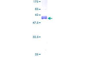 Image no. 1 for Cbp/p300-Interacting Transactivator, with Glu/Asp-Rich Carboxy-terminal Domain, 1 (CITED1) (AA 1-193) protein (GST tag) (ABIN1349515)
