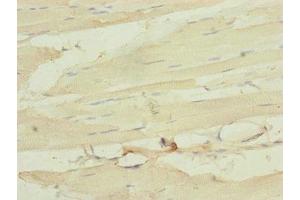 Immunohistochemistry of paraffin-embedded human skeletal muscle tissue using ABIN7160531 at dilution of 1:100