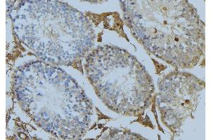 ABIN6274993 at 1/100 staining Mouse testis tissue by IHC-P.