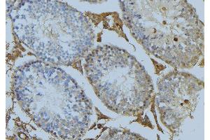 ABIN6274993 at 1/100 staining Mouse testis tissue by IHC-P. (CEP78 anticorps  (Internal Region))