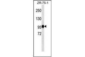 Western blot analysis of PHF14 Antibody (N-term) in ZR-75-1 cell line lysates (35ug/lane). (PHF14 anticorps  (N-Term))