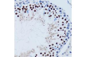 Immunohistochemistry of paraffin-embedded mouse testis using TP53 antibody (ABIN5999084) at dilution of 1/100 (40x lens). (p53 anticorps)