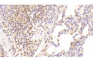 Detection of F2 in Human Lung Tissue using Monoclonal Antibody to Coagulation Factor II (F2) (Prothrombin anticorps)