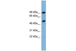 WB Suggested Anti-WIPI1 Antibody Titration: 0. (WIPI1 anticorps  (Middle Region))