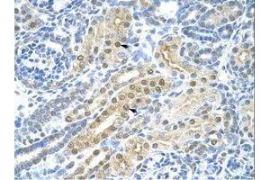 Image no. 1 for anti-Transcription Factor AP-2 gamma (Activating Enhancer Binding Protein 2 Gamma) (TFAP2C) (N-Term) antibody (ABIN203339)