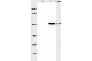 Lane 1: rat liver lysates Lane 2: rat brain lysates probed with Anti CK12/Cytokeratin 12 Polyclonal Antibody, Unconjugated (ABIN872955) at 1:200 in 4 °C. (KRT12 anticorps  (AA 151-250))