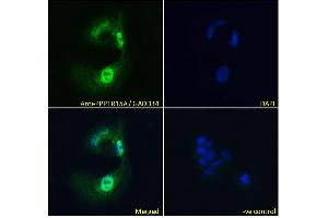 ABIN184571 Immunofluorescence analysis of paraformaldehyde fixed HepG2 cells, permeabilized with 0.