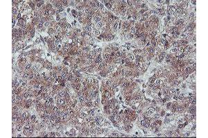 Image no. 1 for anti-Fragile X Mental Retardation 1 (FMR1) (AA 26-279) antibody (ABIN1491292)