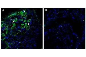 Expression of Piezo2 in rat dorsal root ganglion.