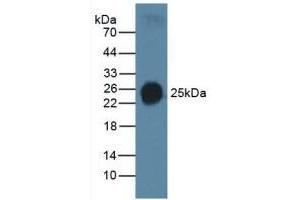 Detection of SP-C in Human Serum using Polyclonal Antibody to Surfactant Protein C (SP-C) (Surfactant Protein C anticorps  (AA 24-197))