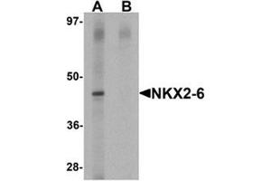 Western blot analysis of NKX2-6 in mouse spleen tissue lysate with NKX2-6 antibody at 1 ug/mL in (A) the absence and (B) the presence of blocking peptide.