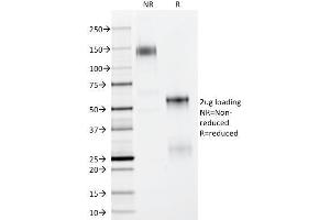 SDS-PAGE Analysis Purified p63 Mouse Monoclonal Antibody (TP63/11). (p63 anticorps)