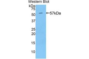 Western blot analysis of the recombinant protein. (TGM1 anticorps  (AA 496-760))
