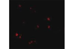 Immunofluorescence staining of human brain tissue with 20 ug/mL LASS5 polyclonal antibody . (LASS5 anticorps  (C-Term))
