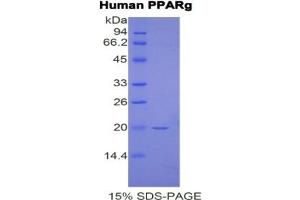 SDS-PAGE of Protein Standard from the Kit (Highly purified E. (PPARG Kit ELISA)
