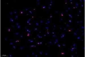 Immunofluorescent analysis of paraformaldehyde-fixed rat heart using,NCAPG2 (ABIN7074856) at dilution of 1: 1000 (NCAPG2 anticorps)