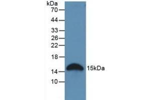 Detection of GAL2 in Rat Stomach Tissue using Polyclonal Antibody to Galectin 2 (GAL2) (Gallinacin-2 (GAL2) (AA 1-130) anticorps)