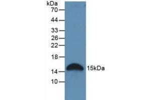 Detection of GAL2 in Rat Stomach Tissue using Polyclonal Antibody to Galectin 2 (GAL2) (Galectin 2 anticorps  (AA 1-130))