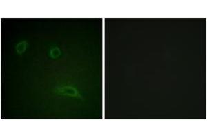 Immunofluorescence analysis of HeLa cells, using HER2 (Ab-1139) Antibody. (ErbB2/Her2 anticorps  (AA 1111-1160))