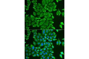 anti-N-Acylaminoacyl-Peptide Hydrolase (APEH) (AA 1-260) antibody