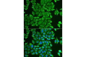 Immunofluorescence analysis of HeLa cells using APEH antibody. (APEH anticorps  (AA 1-260))