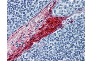 Anti-SPRR3 antibody IHC of human tonsil. (SPRR3 anticorps  (AA 1-162))