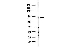 Western blot analysis of lysates from Hela cells(starvation 24h treatment), using Cholinesterase/BCHE Antibody at 1/1000 dilution.