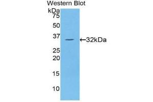 Western Blotting (WB) image for anti-Protein Kinase C, eta (PRKCH) (AA 355-614) antibody (ABIN1860237) (PKC eta anticorps  (AA 355-614))