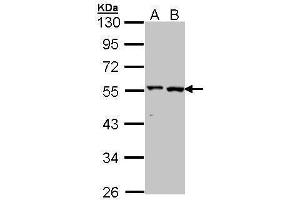 WB Image Sample (30 ug of whole cell lysate) A: A431 , B: Hela 10% SDS PAGE antibody diluted at 1:1000 (ALT anticorps  (N-Term))