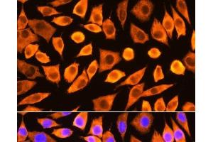 Immunofluorescence analysis of L929 cells using RPS3 Polyclonal Antibody at dilution of 1:100.