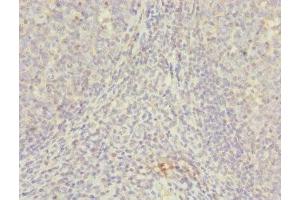 Immunohistochemistry of paraffin-embedded human tonsil tissue using ABIN7145623 at dilution of 1:100 (NUDT2 anticorps  (AA 1-147))
