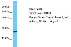 Host: Rabbit Target Name: ORC6 Sample Type: Thyroid Tumor lysates Antibody Dilution: 1. (ORC6 anticorps  (N-Term))