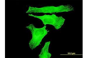 Immunofluorescence of monoclonal antibody to TAOK3 on HeLa cell.