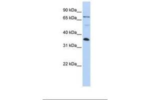 Image no. 1 for anti-LIM and SH3 Protein 1 (LASP1) (AA 182-231) antibody (ABIN6738999) (LASP1 anticorps  (AA 182-231))