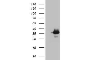 Western Blotting (WB) image for anti-Aspartoacylase (ASPA) (AA 77-313) antibody (ABIN2716065) (ASPA anticorps  (AA 77-313))
