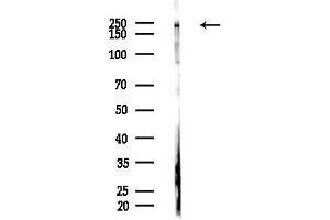 Western blot analysis of lysates from F10-HUC(heat-shock,45 min treatment), using NUP205 Antibody at 1/1000 dilution.