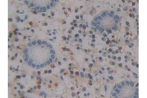 Detection of MCP4 in Human Stomach Tissue using Polyclonal Antibody to Monocyte Chemotactic Protein 4 (MCP4)