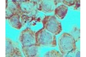 Image no. 2 for anti-Distal-Less Homeobox 3 (DLX3) (AA 220-270) antibody (ABIN960137) (DLX3 anticorps  (AA 220-270))