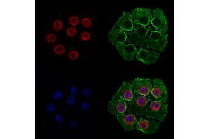 ABIN6262331 and ABIN6277975 staining HepG2 cells by IF/ICC. (HNRNPUL1 anticorps  (C-Term))