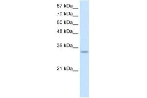 PRKRA antibody used at 1 ug/ml to detect target protein. (PRKRA anticorps  (Middle Region))