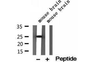 Western blot analysis of extracts of mouse brain tissue, using IFT25 antibody.