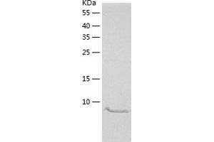 Western Blotting (WB) image for Matrix Gla Protein (MGP) (AA 20-96) protein (His tag) (ABIN7123851) (MGP Protein (AA 20-96) (His tag))