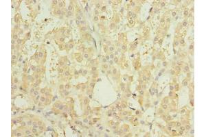 Immunohistochemistry of paraffin-embedded human adrenal gland tissue using ABIN7151150 at dilution of 1:100 (RNF138 anticorps  (AA 2-245))