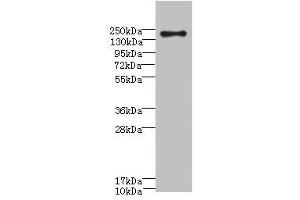 Western blot All lanes: CR1 antibody at 3. (CD35 anticorps  (AA 420-550))