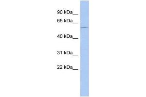 WB Suggested Anti-DMRT2 Antibody Titration: 0. (DMRT2 anticorps  (N-Term))