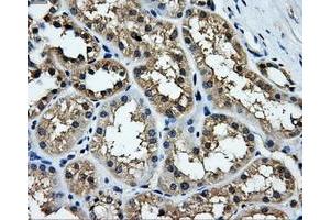 Immunohistochemical staining of paraffin-embedded liver tissue using anti-TTLL12mouse monoclonal antibody. (TTLL12 anticorps)