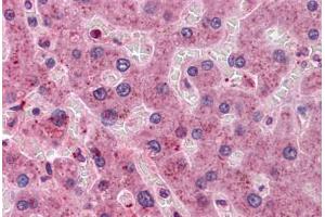 Human Liver: Formalin-Fixed, Paraffin-Embedded (FFPE) (HYI anticorps  (AA 1-218))
